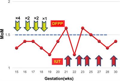 Case report: Double filtration plasmapheresis (DFPP) for severe rhesus-D alloimmunization in two pregnant patients